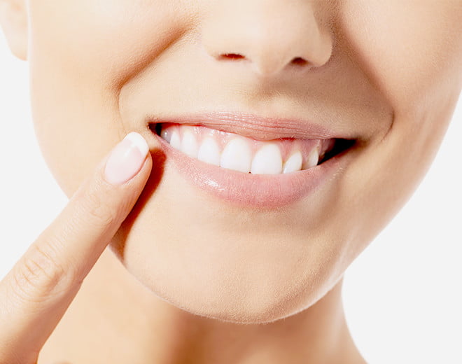 WHITENING & REGULAR CHECKUP