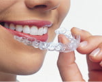 Invisalign